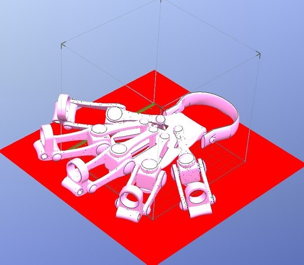 3D Printed Exoskeleton Hands - In One Piece - STL Files