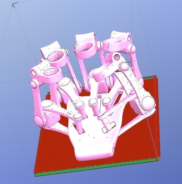 3D Printed Exoskeleton Hands - In One Piece - STL Files