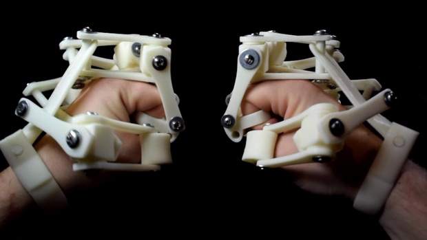 3D Printed Exoskeleton Hands - STL Files