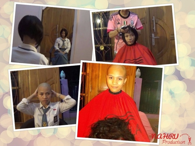 BALD#004