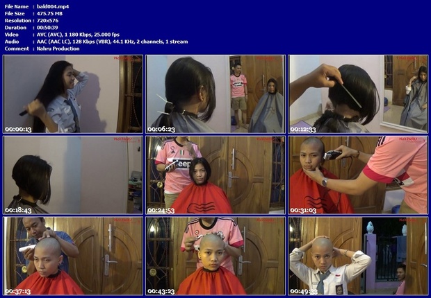 BALD#004