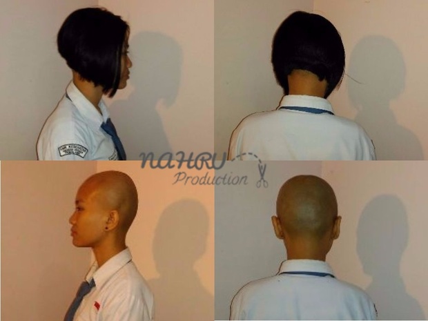 BALD#004