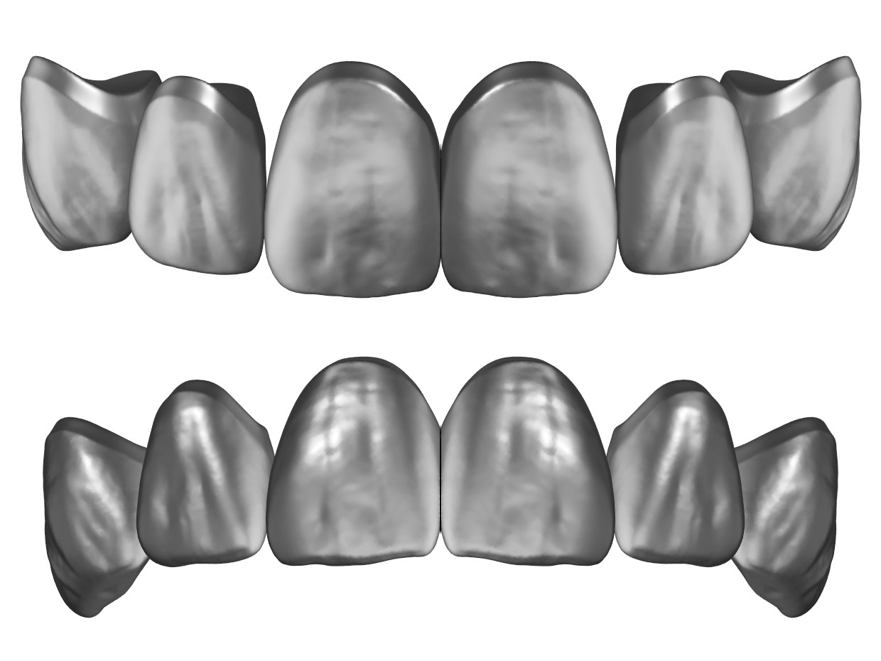 3SHAPE ANTERIOR DEMO LIBRARY DENTAL CAD SHOP