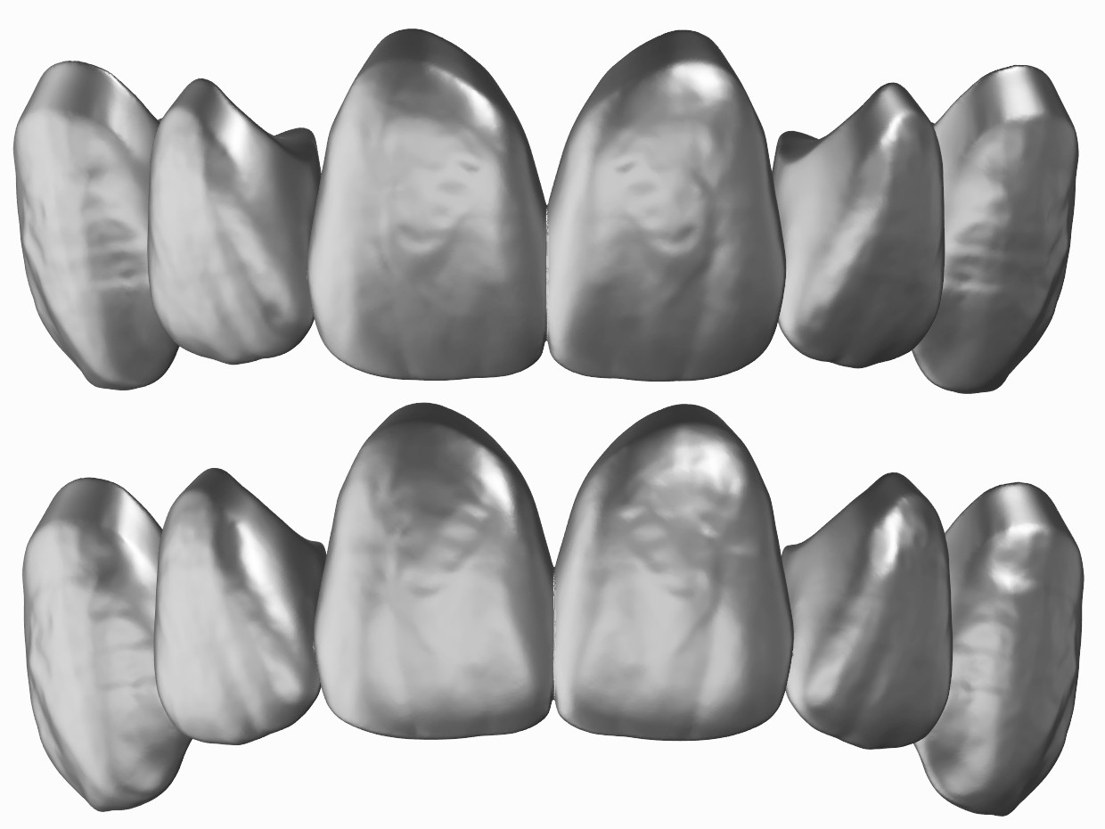3SHAPE MEMBRANE HD COLLECTION 14. ANTERIOR LIBRARY DENTAL CAD SHOP