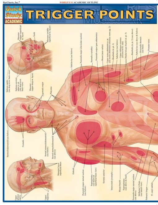 Trigger Points