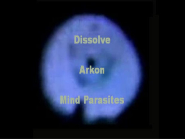 Archon Mind Parasites MP3