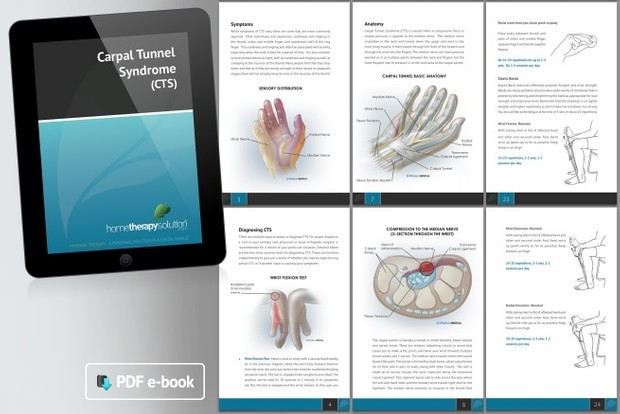 Carpal Tunnel Syndrome Therapy Book