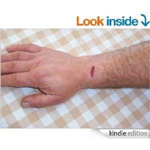 NOESITHERAPY - A Psychological Approach To Pain Control